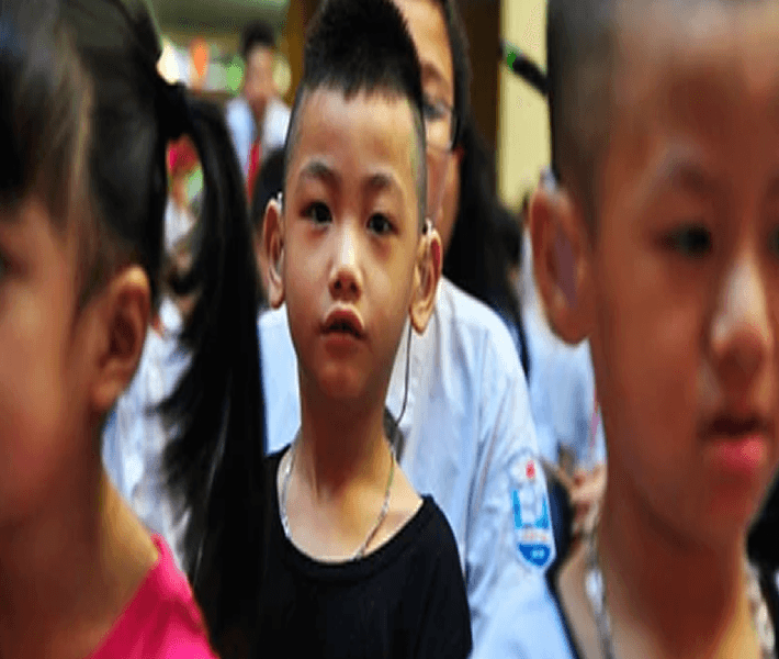 Sự khẩn cấp trong điều trị khiếm thính cho trẻ em